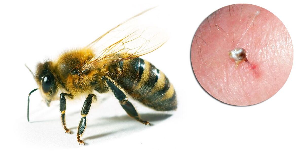 Hondrostrong съдържа пчелна отрова, която подобрява метаболитните процеси в тъканите